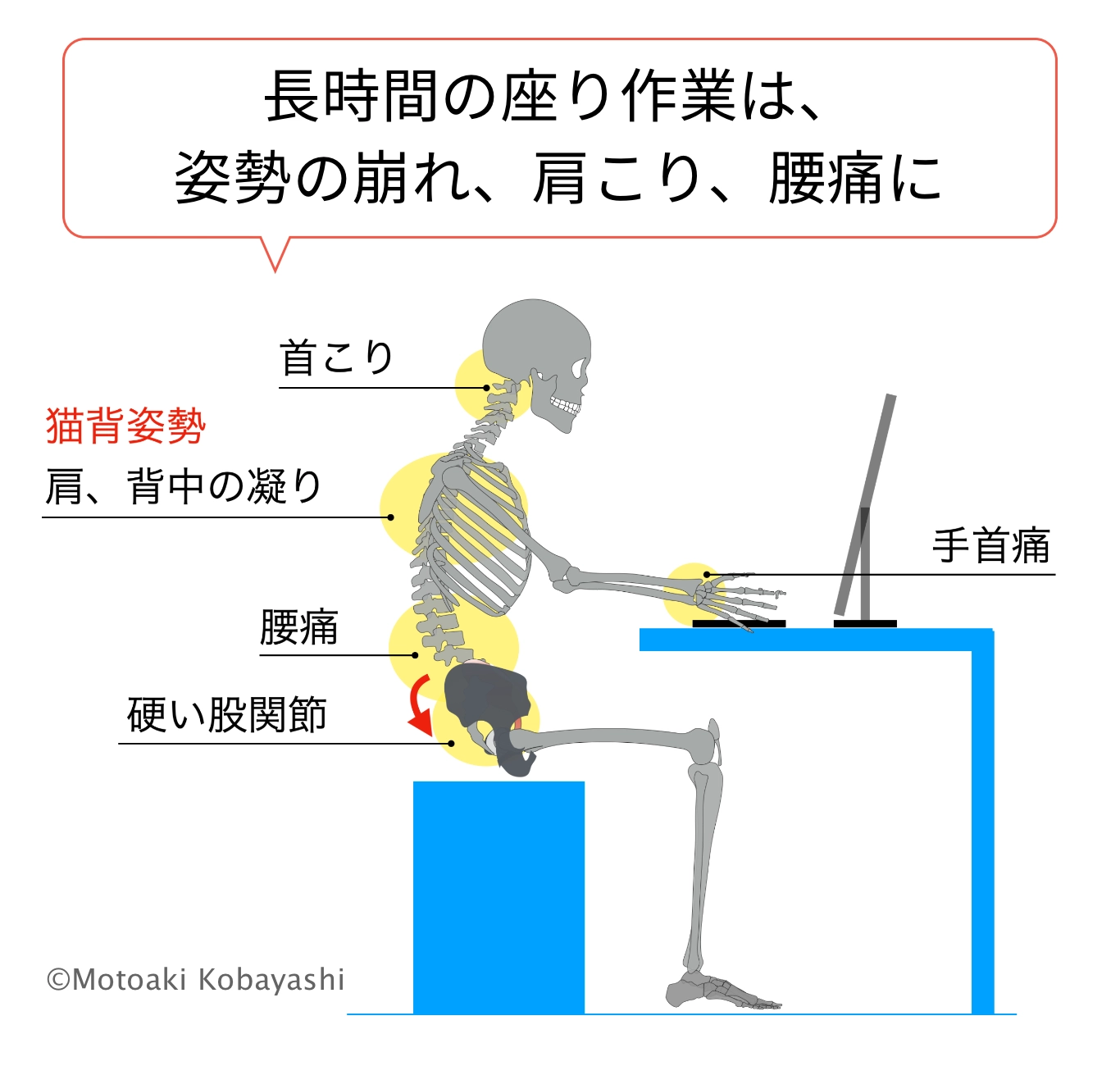デスクワーク　骨盤後傾、腰痛肩こりに